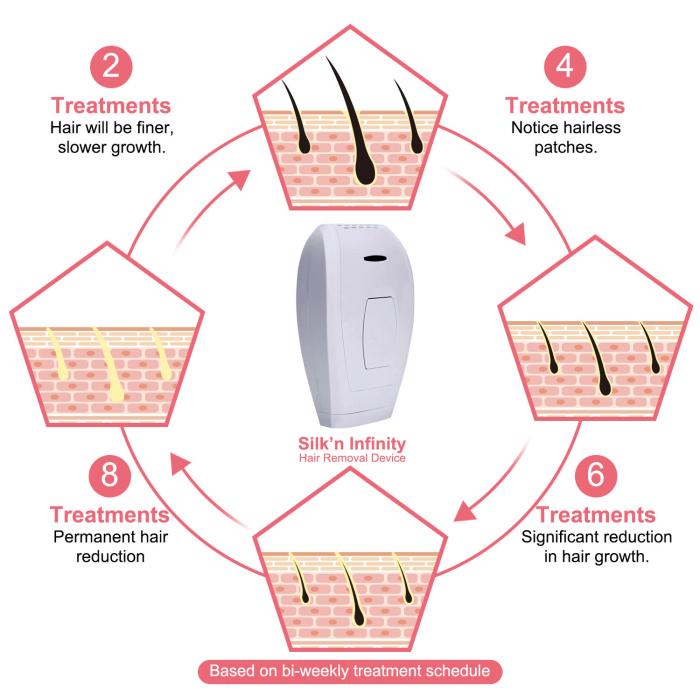 IPL HAIR REMOVAL TMY07