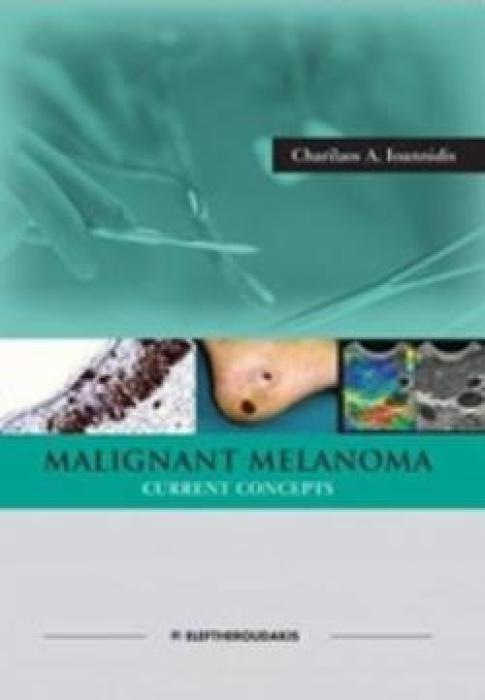 MALIGNANT MELANOMA CURRENT CONCEPTS